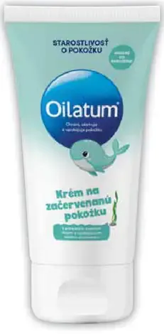 Oilatum krém na začervenanú pokožku